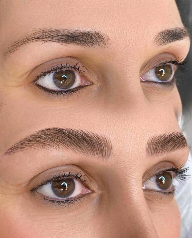 نتیجه نهایی میروبلیدینگ در مرکز نیلوفر اسدی.
