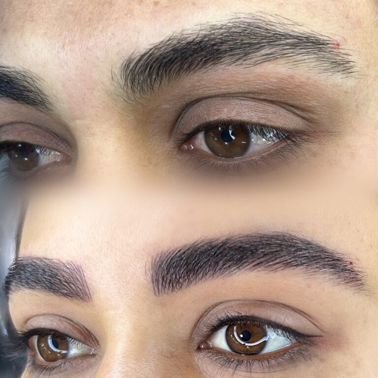 تغییرات حالت چهره قبل و بعد از اجرای میکروبلیدینگ نچرال توسط دنیا جهانگیری