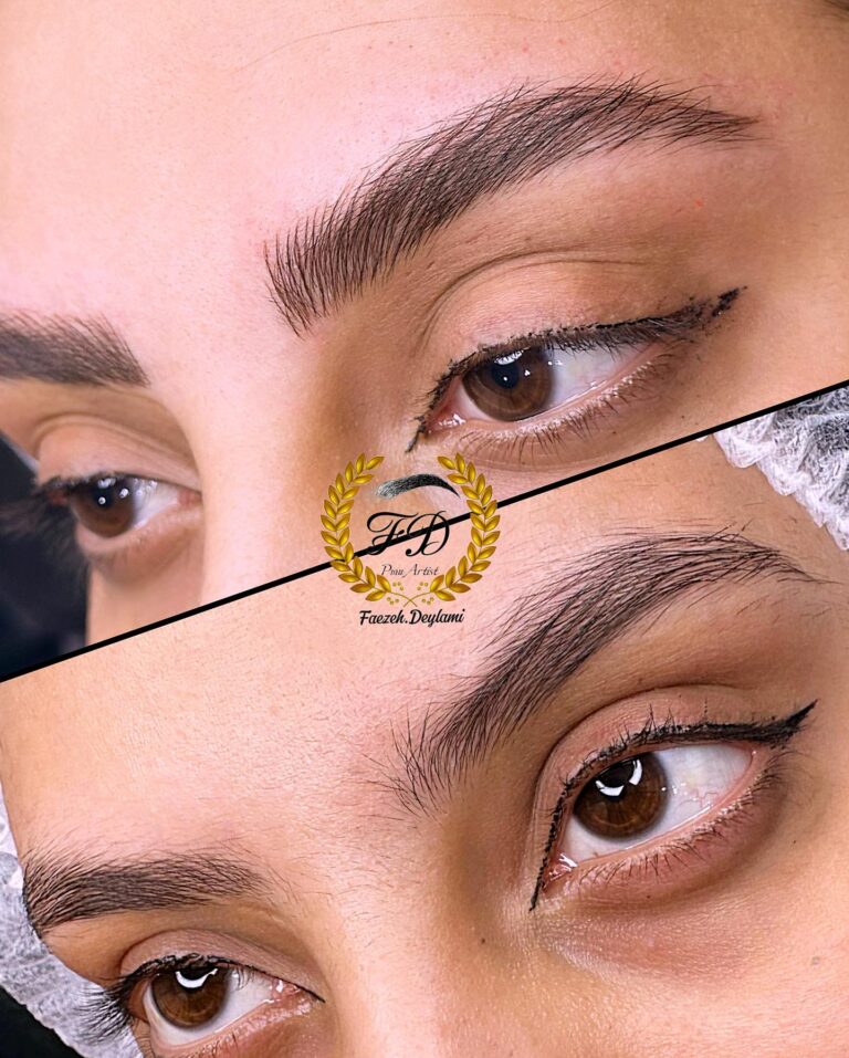 اجرای دقیق تکنیک بولدبروز برای پرپشت کردن ابروها در کلینیک فائزه دیلمی اهواز