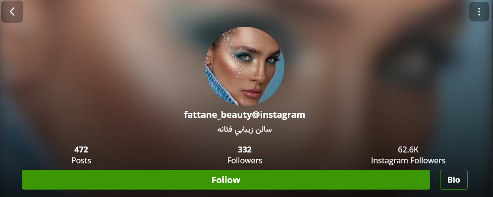 فیبروز و میکروبلیدینگ در تبریز با فتانه