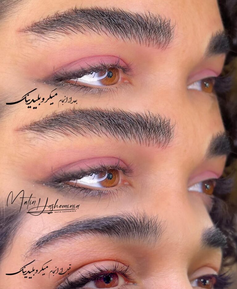 جزئیات رنگ پذیری عالی و خواب طبیعی خطوط میکروبلیدینگ روی بافت پوست