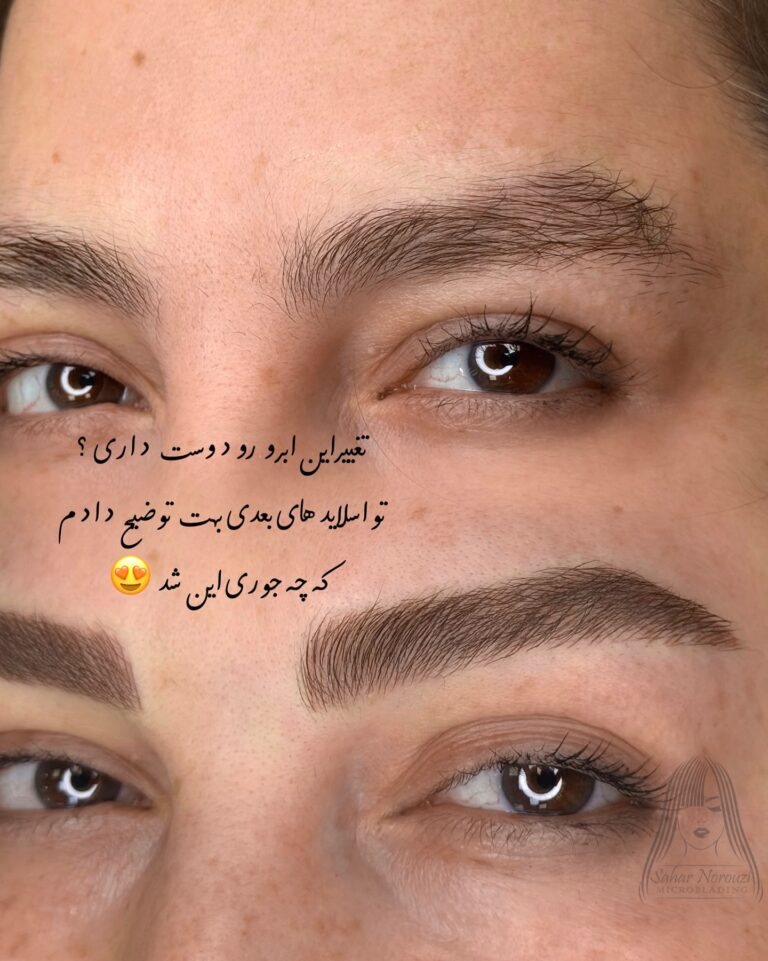 اصلاح فرم، رفع نواقص و قرینه‌سازی تخصصی ابرو با تکنیک‌های جدید در رشت
