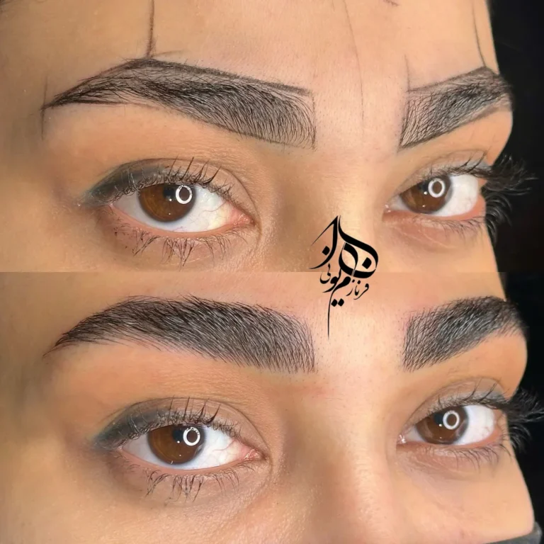نمونه کار قبل و بعد میکروبلیدینگ ابرو (بررسی ظرافت خطوط)