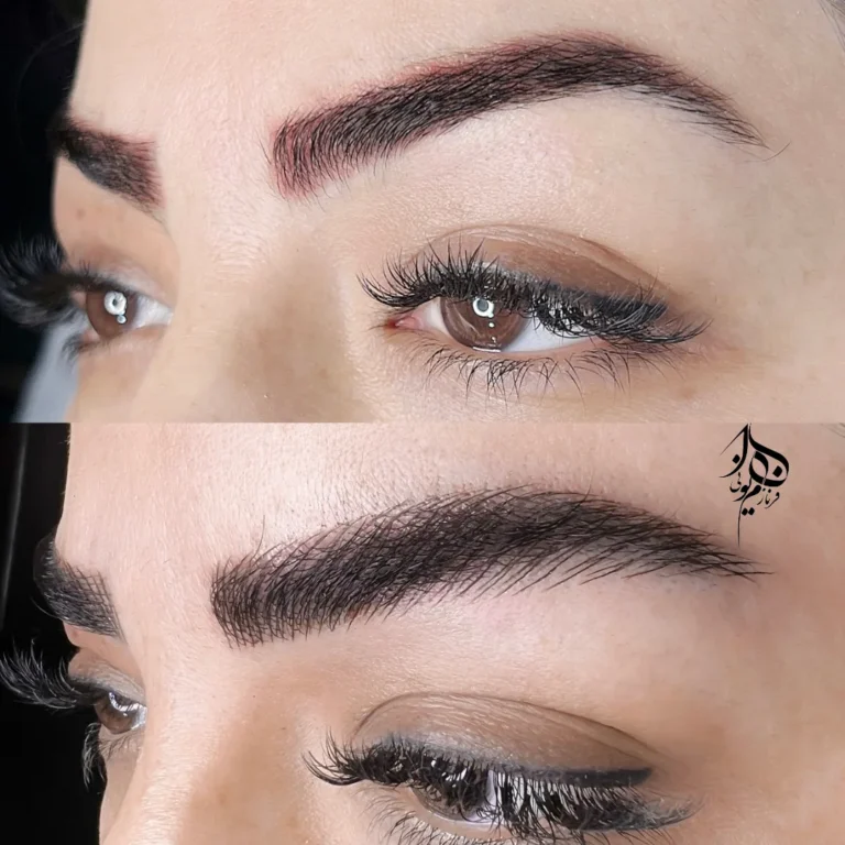 اصلاح فرم و قرینه‌سازی ابرو با تکنیک میکروبلیدینگ