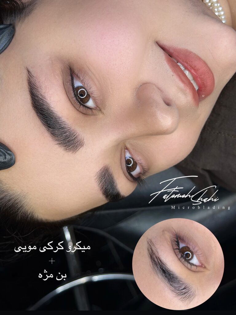 نمای کامل چهره زیباجو پس از اجرای تکنیک میکروبلیدینگ توسط فاطمه شاهی.