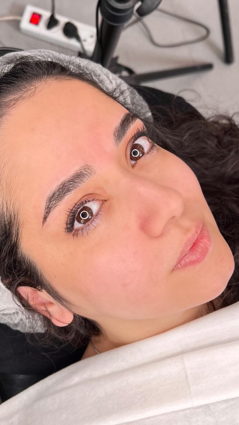 نمای کامل چهره زیباجو پس از اجرای تکنیک میکروبلیدینگ توسط فاطمه شاهی.