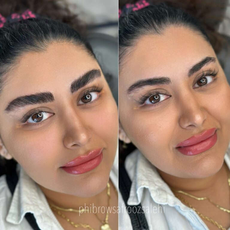 تغییرات چشمگیر قبل و بعد از شیدینگ و هاشور ابرو در کلینیک افروز صالحی.