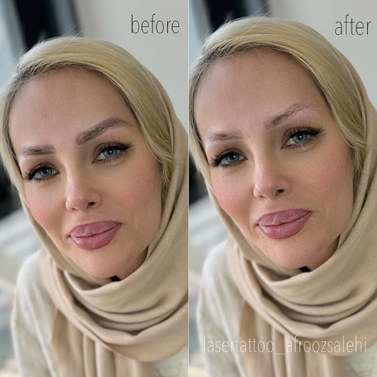 اصلاح فرم ابرو و پرپشت‌سازی با تکنیک‌های جدید در مرکز افروز صالحی کرج.