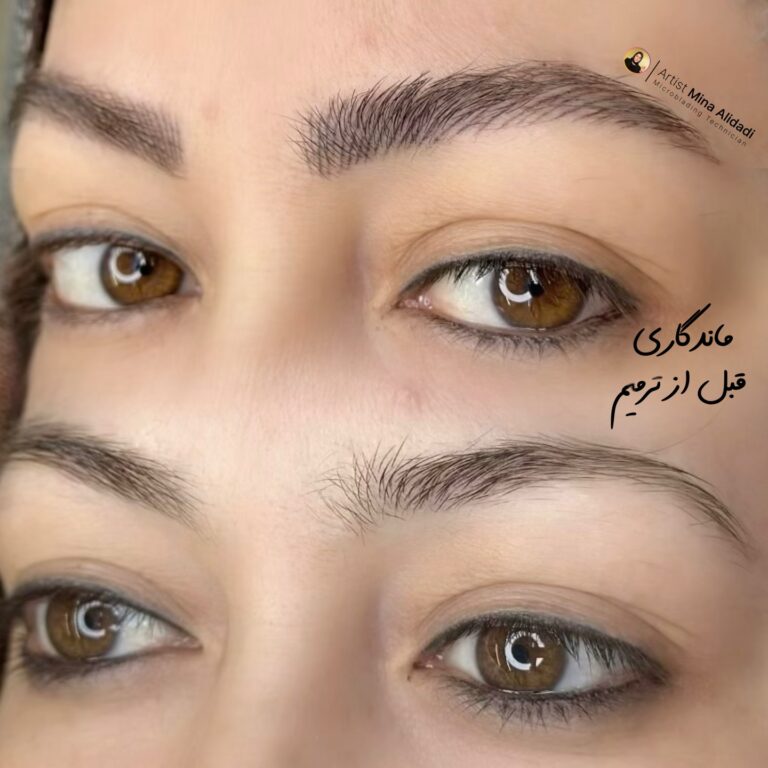 جزئیات میکروبلیدینگ ابرو قبل و بعد از اجرا توسط مینا علیداری